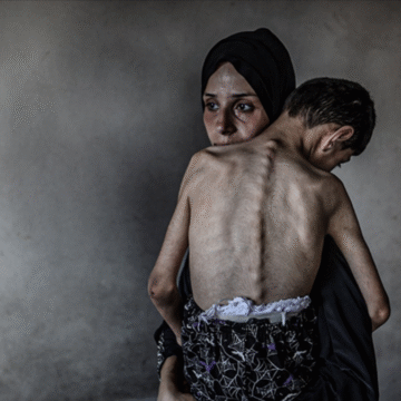 Gazze Şeridi’nde son 24 saatte 5 Filistinli daha açlıktan hayatını kaybetti