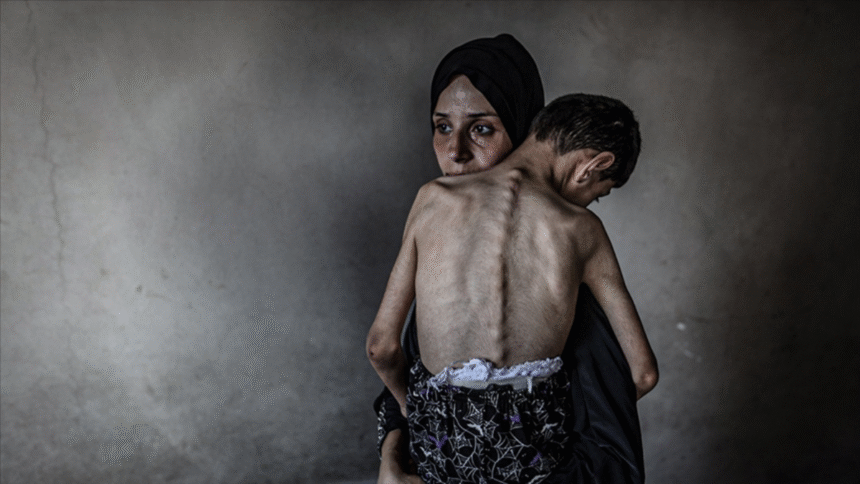 Gazze Şeridi’nde son 24 saatte 5 Filistinli daha açlıktan hayatını kaybetti