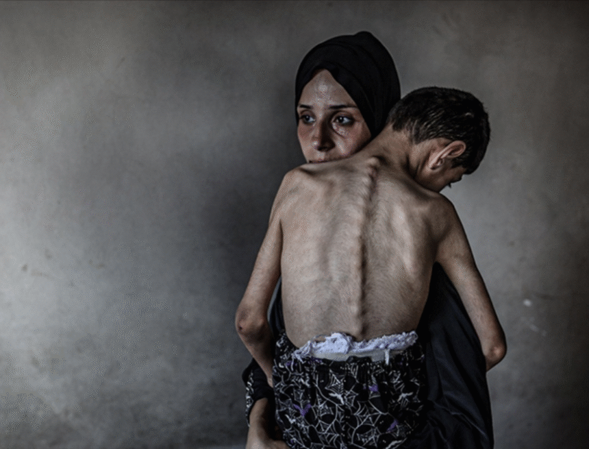 Editör kopyası (4) Gazze Şeridi’nde son 24 saatte 5 Filistinli daha açlıktan hayatını kaybetti